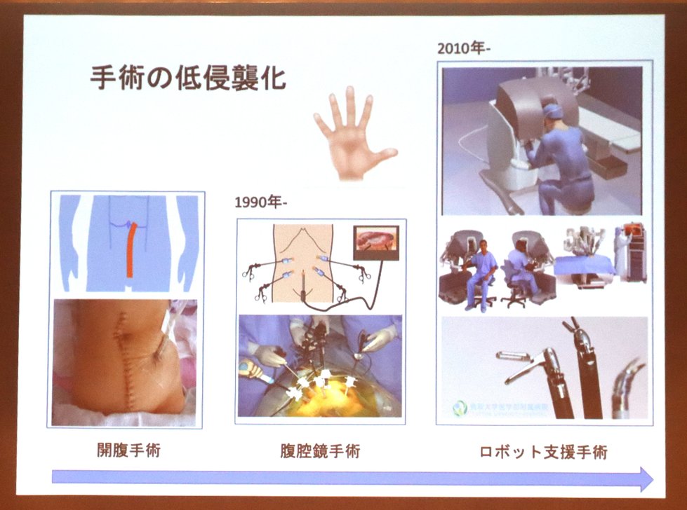 「医療現場の課題～より良い内視鏡を目指して～」